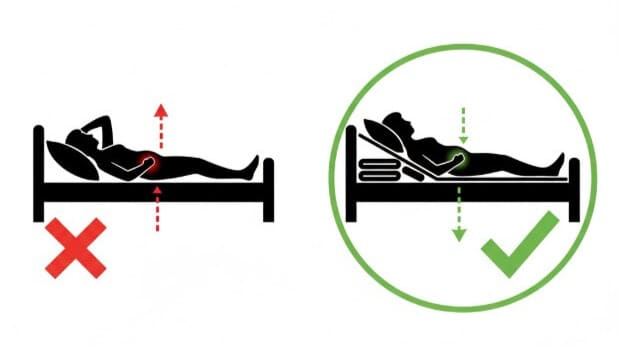 逆流性食道炎の正しい寝方。枕だけでなく、背中から頭にかけて、なだらかな傾斜をつける様子。