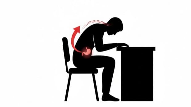 猫背の悪い姿勢が胃を圧迫し、逆流性食道炎の原因となるメカニズムの図解。